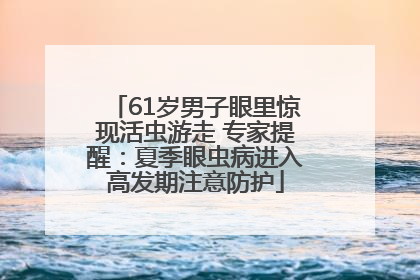 61岁男子眼里惊现活虫游走 专家提醒：夏季眼虫病进入高发期注意防护